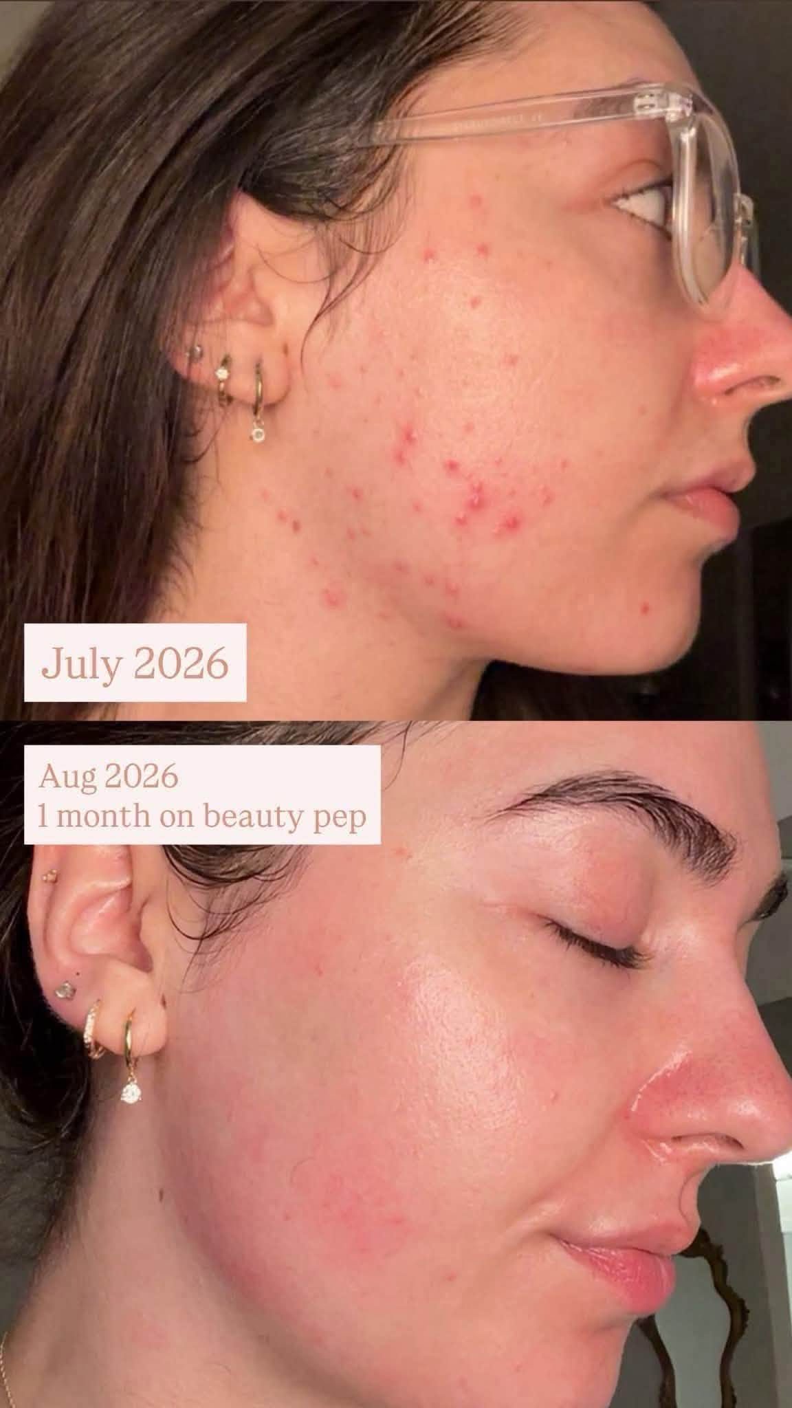 One month on the beauty drink