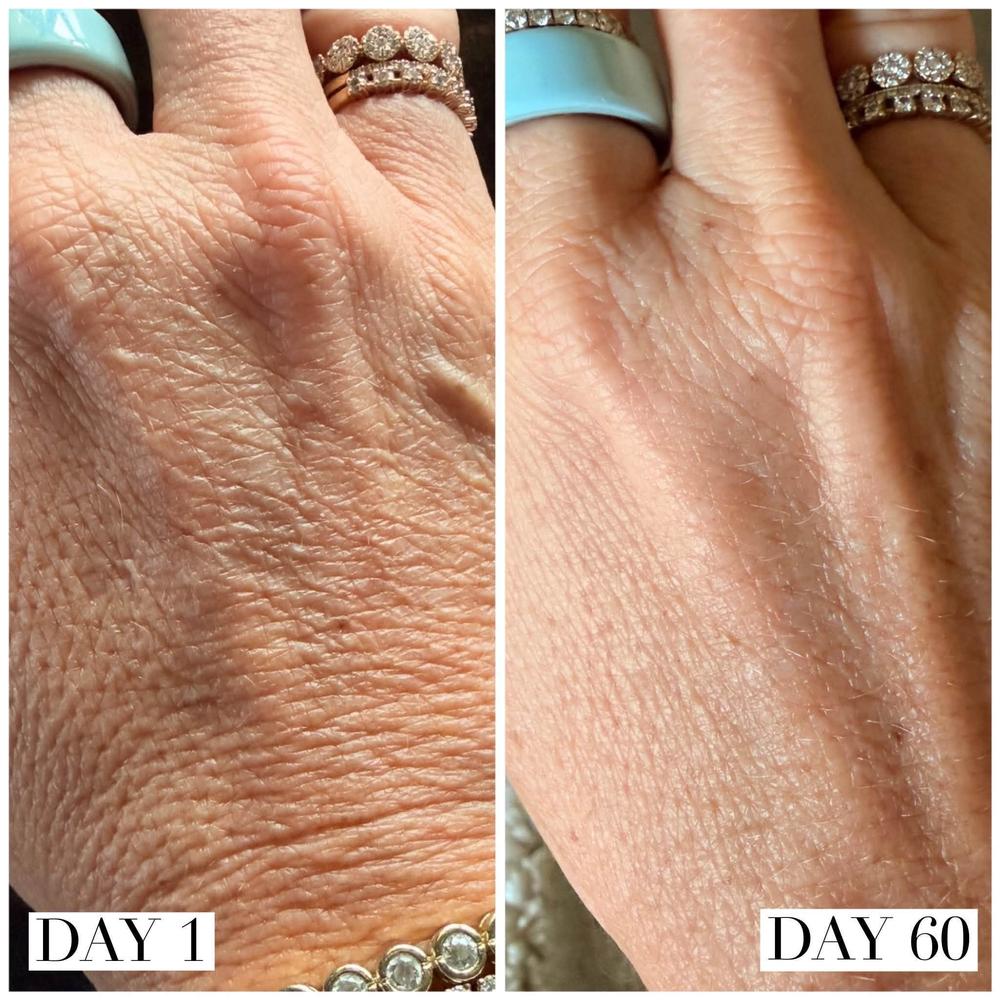 Day 1 → day 60, hands