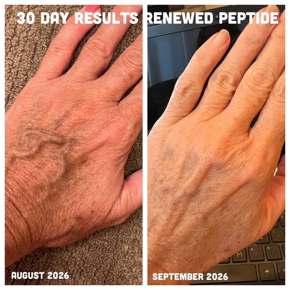 30 days on the Renewed peptide